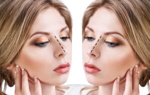 rhinoplastie tunisie