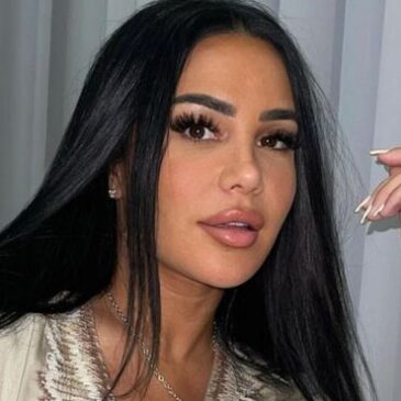 Milla Jasmine et le résultat de sa chirurgie esthétique